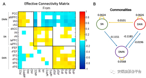 论文4：团队在《Journal of Psychiatry and Neuroscience》上发文阐述抑郁症默认网络、突显网络和背侧注意网络的效应连接异常