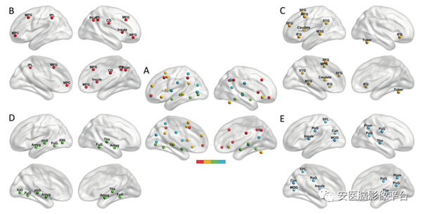 论文5：团队在《Translational Psychiatry》发文阐述利用情绪调节网络的静息态功能连接预测抑郁症患者的病情缓解